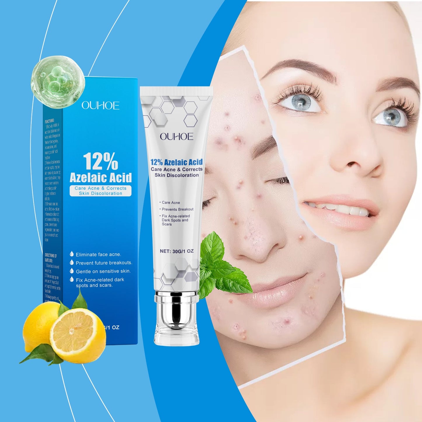 Azelaic Acid Acne Cream Gently Nourishes And Moisturizes Skin And Balances Oil And AcneOuhoe Azelaic Acid Acne Cream Gently Nourishes And Moisturizes Skin And Balances Oil And Acne
