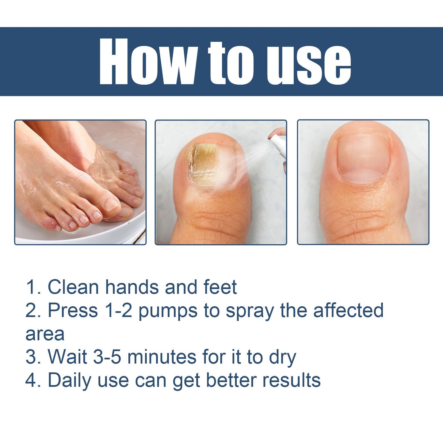 Nail Care Spray Gently Cleans Foot Nails Moisturizing And Brightening Nail Care Spray