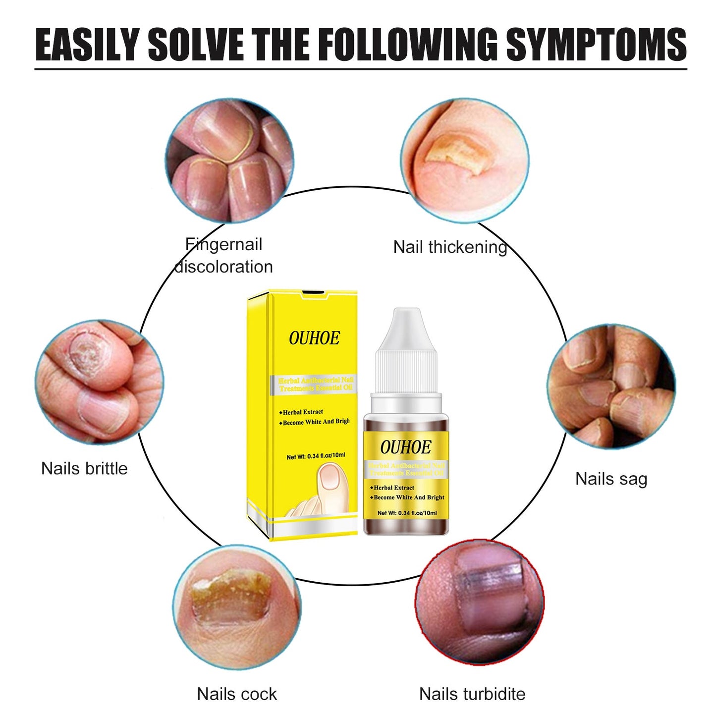 Herbal Antibacterial Nail Treatments Essential Oil, Grey Nail Care Essential Oil Brightening Nail Polish Clean Manicure Foot Care Solution