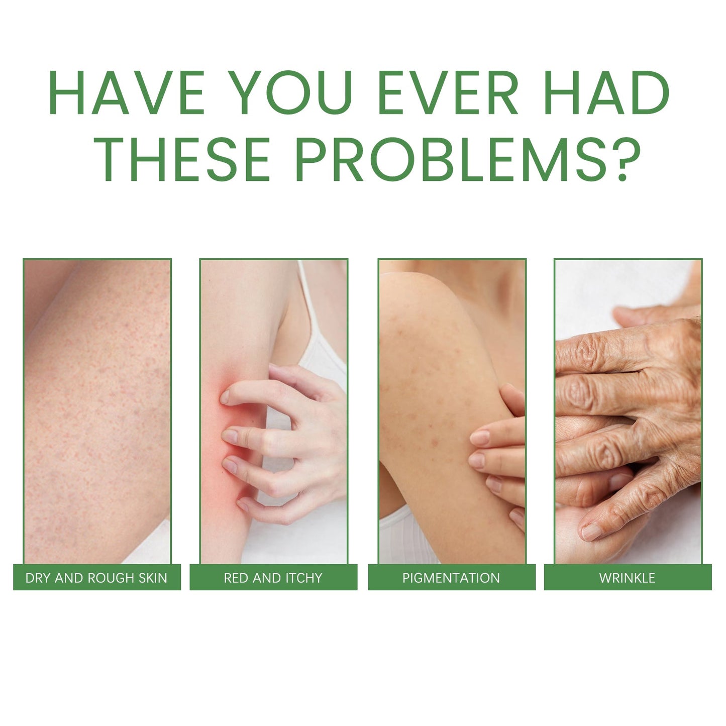 Firming Collagen Body Cream Moisturizes And Repairs Chicken Skin, Prevents Dry, Tender And Smooth Skin, Brightening And Beautifying Skin