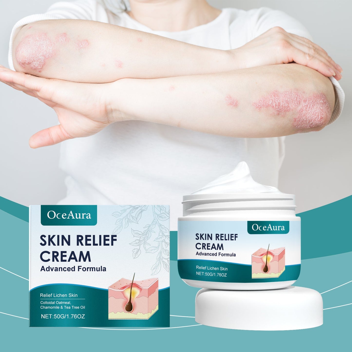 Hair Follicle Care Cream Care Scalp Back Face Clean Repair Acne Hair Follicle Care Cream