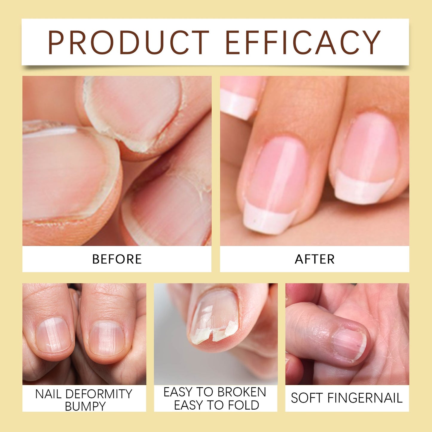 Jojoba Oil For Nails, Nail Care Anti-Barb Edge Oil Softening Nourishing Base Oil For Nail Protectors