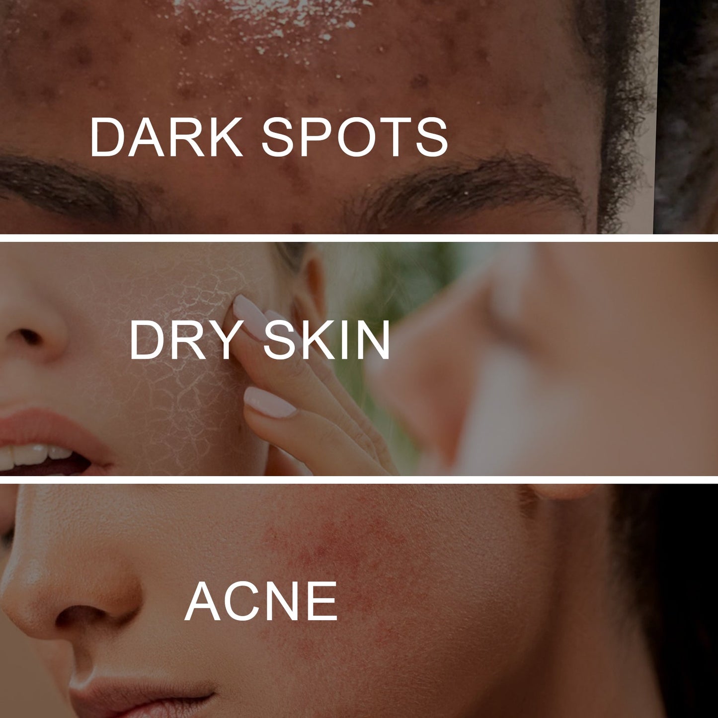 Dark Spot Whitening Cream, Lightening Yellow Brown White Spot Cream Dark Spots Correct Skin Tone Moisturize Skin Whitening