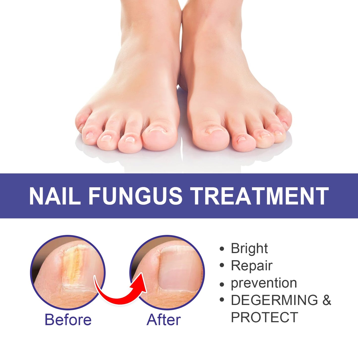 Nail Repair Lotion, Repair Thickening Nail Inlay Gray Nail Shine Soft Nail Care Solution