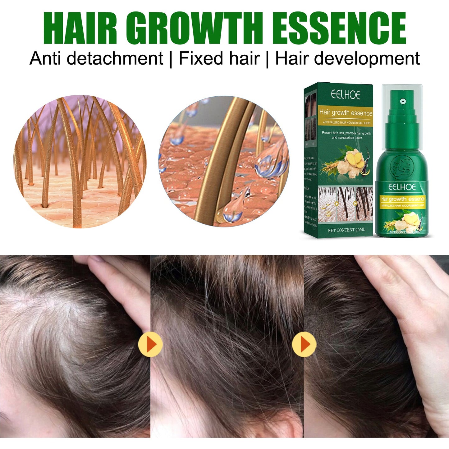 Ginger Hair Growth Spray, Nourishing And Nourishing Hair Root, Hair Care Solution To Prevent Scalp Loss