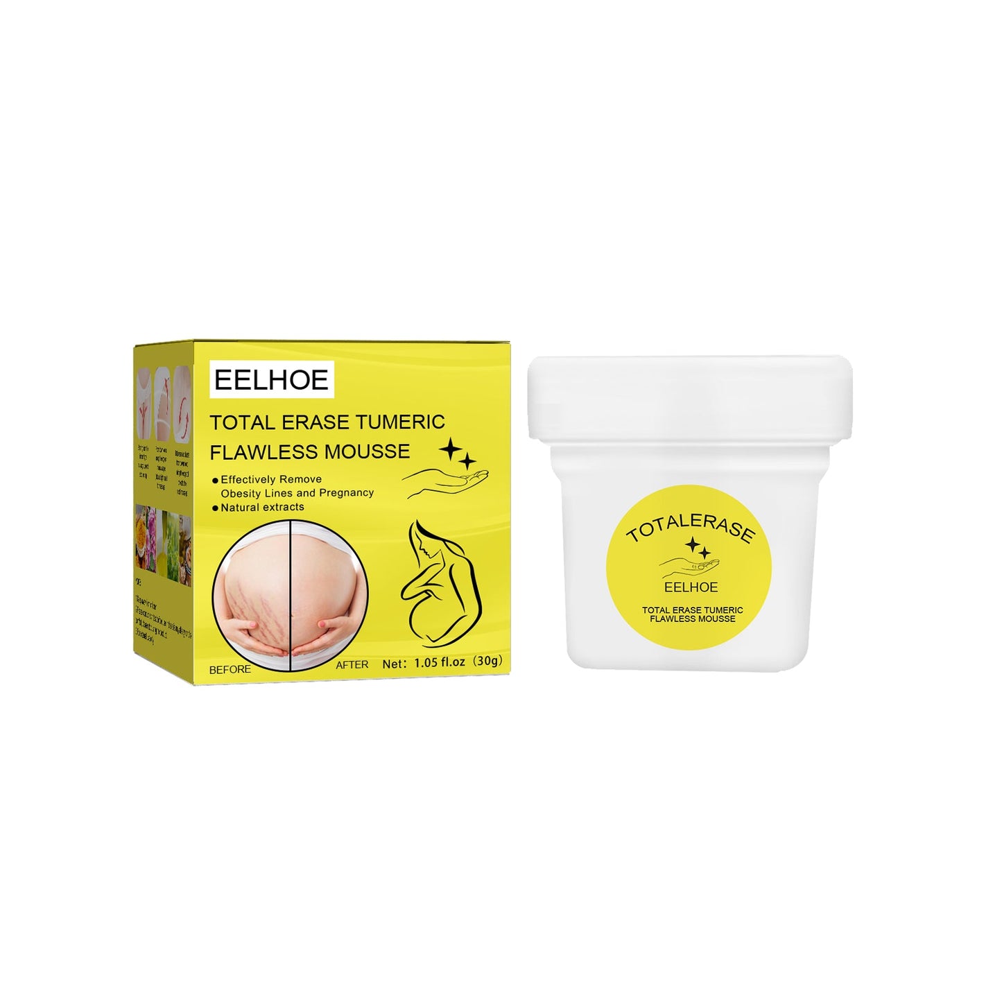 Skin Care Cream, Pregnant Women's Body Skin Gentle Repair Daily Care Moisturizing Moisturizer