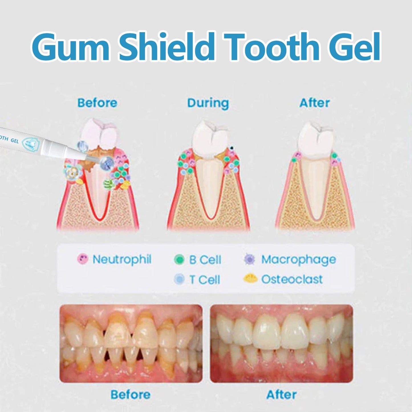 Gingival Oral Gel Pen, Clean Tooth Stains, Care For Gums, White Teeth, Oral Care Gel Pen