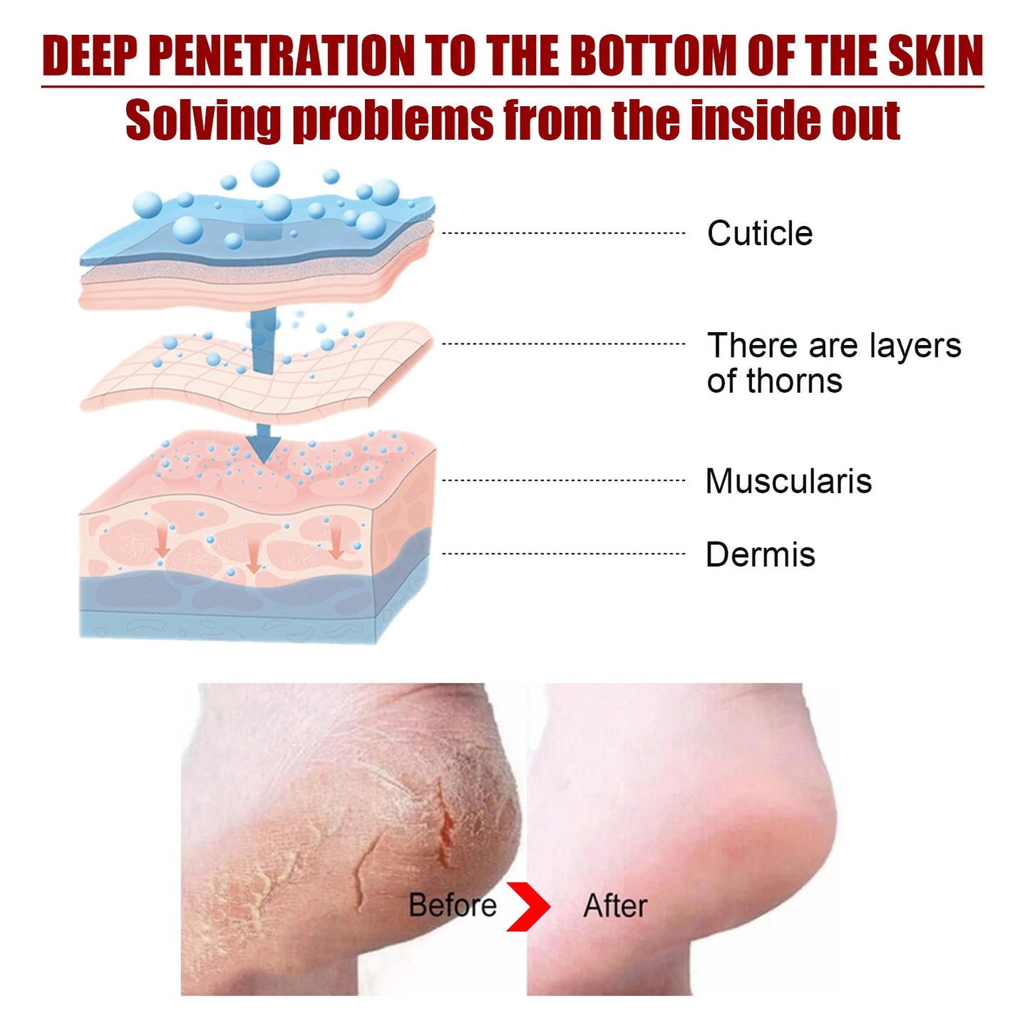 Exfolating Foot Mask, Tender Skin To Moist Calluses To Exfoliate Dead Skin Hydrating Foot Care