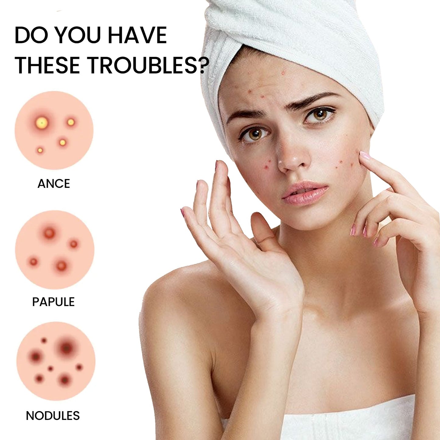 Pimples Patch, Repair Pockmarks Lighten Pimples Blemishes Cover Pimples